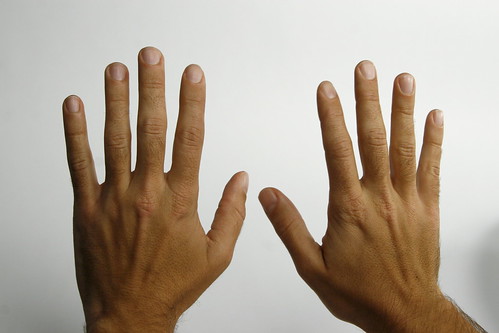 причины онемения пальцев рук
