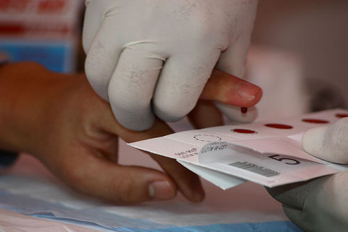 Взятие крови из пальца на анализы - врач гематолог